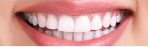 A bright smile showing the results of successful teeth whitening, at Barron Dental, Leith, Edinburgh. Teeth whitening Edinburgh