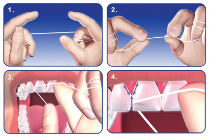 Why I floss? - Barron Dental